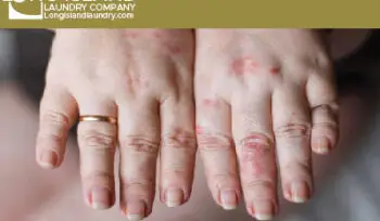 laundry detergent on skin